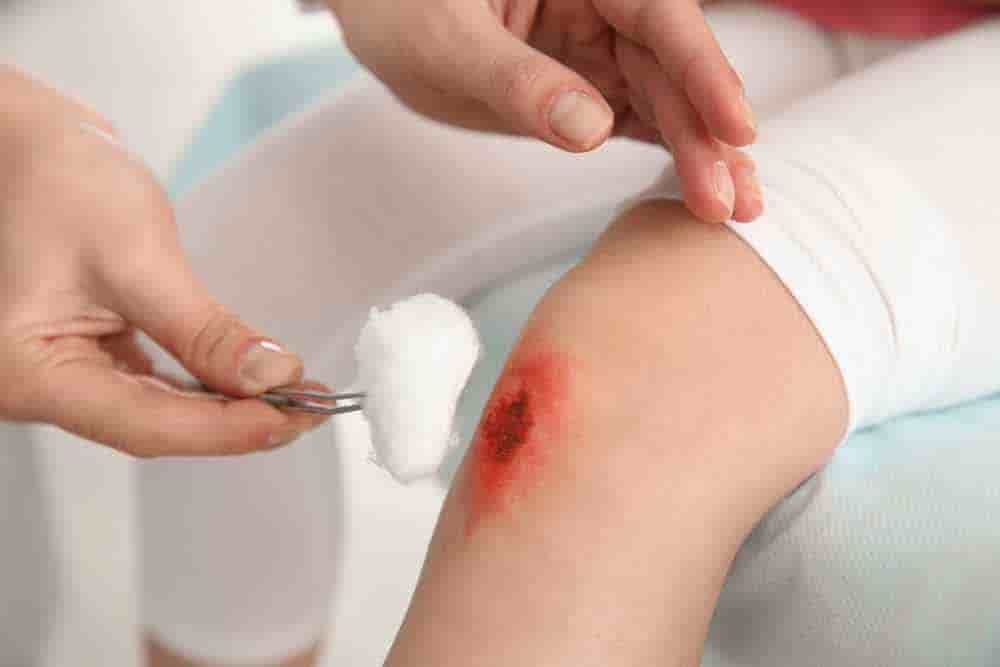 wound-image